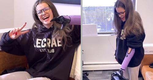 15-jähriges Mädchen lächelt wieder: Mit ihrer neuen Prothese fühlt sie sich wie eine Superheldin (+ VIDEO)